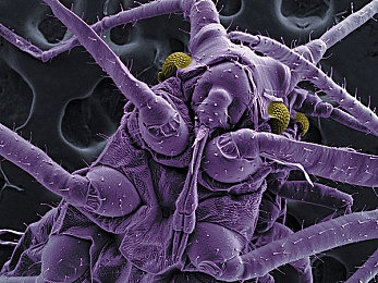 王者荣耀瑶嘴巴里含着铁球,神秘瑶嘴含铁球，王者荣耀新角色引关注-2